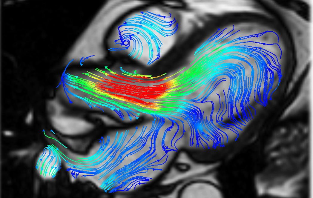 Interview with Dr Pankaj Garg: UEA Scientist develops new MRI technique